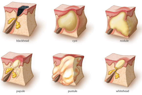 zit pus under microscope